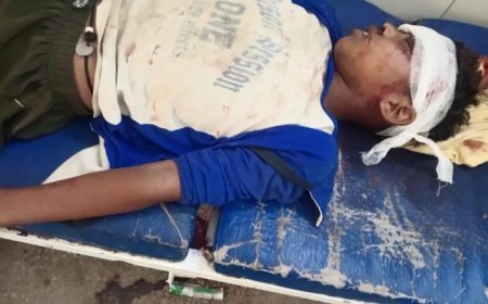 Hardoi : दो बाइकों की आमने-सामने भिड़ंत, दो युवक गंभीर रूप से घायल