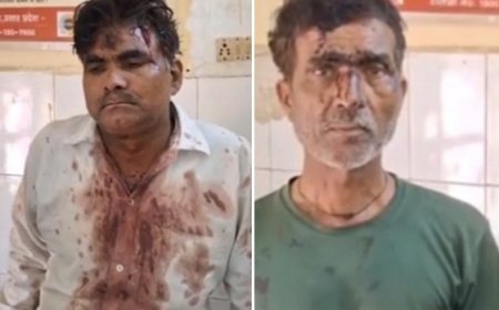 Hardoi: जमीन विवाद में मामा-भांजे को पीटाः घायल ने तीन लोगों पर मारपीट का आरोप। 