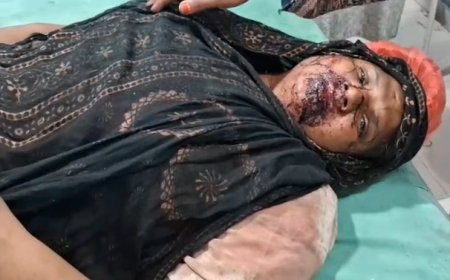 Deoband : बच्चों के विवाद की शिकायत करने गई महिला पर पड़ोसियों का हमला, हालत गंभीर होने पर बड़े अस्पताल रेफर