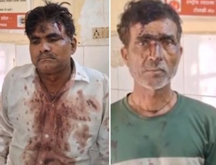 Hardoi: जमीन विवाद में मामा-भांजे को पीटाः घायल ने तीन लोगों पर मारपीट का आरोप। 