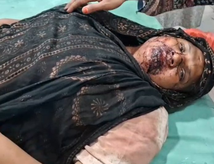 Deoband : बच्चों के विवाद की शिकायत करने गई महिला पर पड़ोसियों का हमला, हालत गंभीर होने पर बड़े अस्पताल रेफर