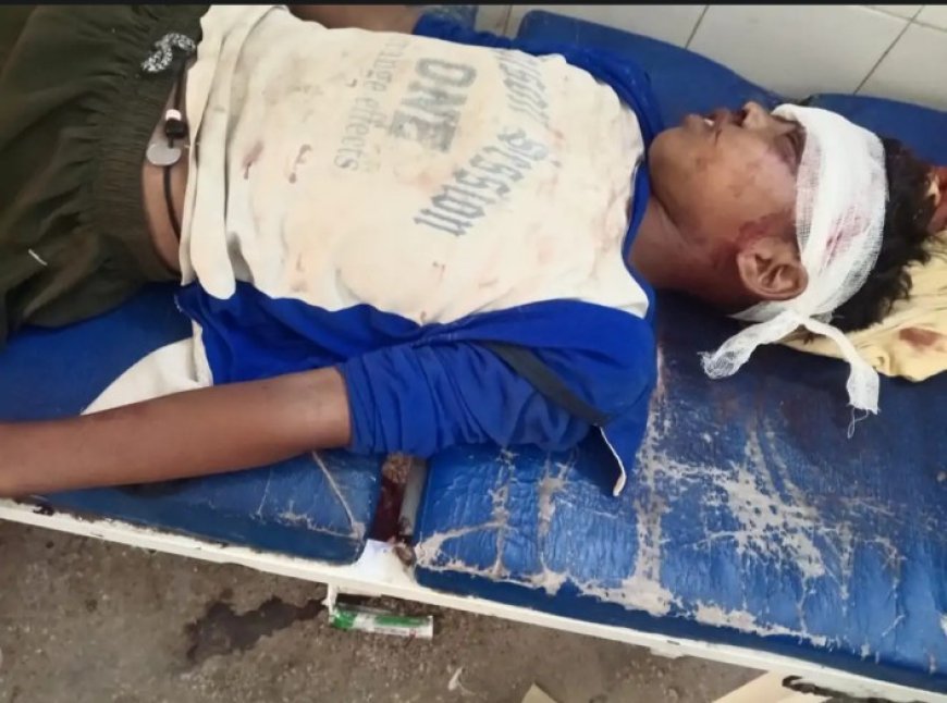 Hardoi : दो बाइकों की आमने-सामने भिड़ंत, दो युवक गंभीर रूप से घायल