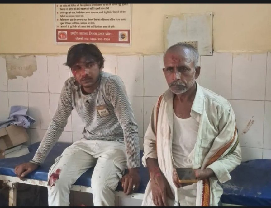 Hardoi : बाइक और साइकिल की भिड़ंत में दो लोग गंभीर रूप से घायल, हाईवे पर हुआ हादसा
