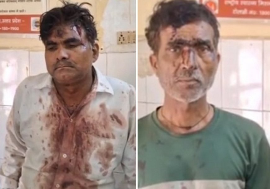 Hardoi: जमीन विवाद में मामा-भांजे को पीटाः घायल ने तीन लोगों पर मारपीट का आरोप। 