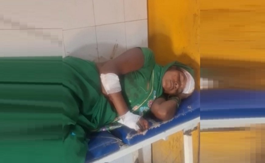 Hardoi: हाईवे के गड्ढे ने ली फिर जानलेवा करवट, बाइक फिसलने से महिला गंभीर घायल। 