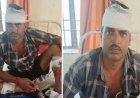 Hardoi : कुल्हाड़ी से हमले में पिता-पुत्र घायल, पांच लोगों के खिलाफ शिकायत दर्ज