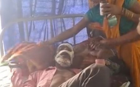 Hardoi : रिश्तेदार के अंतिम संस्कार से लौट रहे बाइक सवार की गाड़ी मुड़ते समय पलटी, हालत चिंताजनक