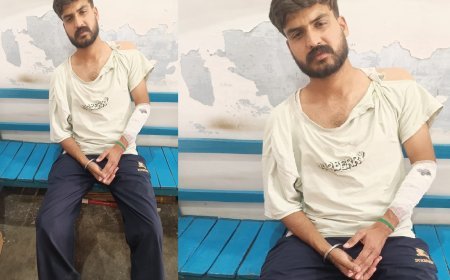 Bajpur : बाजपुर में खेत पर धान लगा रहे दो भाइयों पर धारदार हथियार से जानलेवा हमला