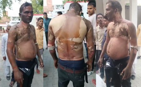 Sambhal : मुकदमे के डर से ग्रामीण ने खुद को लगाई आग, छेड़छाड़ के आरोप पर SP का बड़ा बयान