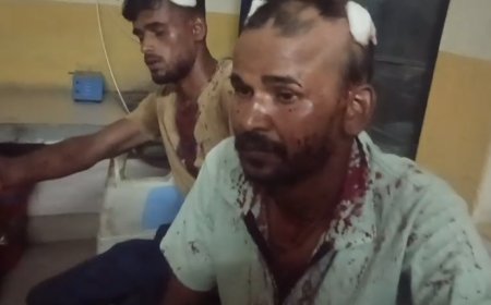 Sambhal : पुरानी रंजिश को लेकर दो पक्षों में खूनी संघर्ष, फायरिंग में युवक को लगी गोली, छह घायल
