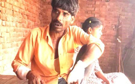 Sitapur : खेत में चारा काटने गए ग्रामीण पर जंगली सियार का जानलेवा हमला, चीख-पुकार सुनकर दौड़े ग्रामीणों ने बचाई जान