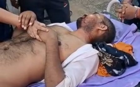Hardoi : ट्रैक्टर-ट्राली का कुंडा टूटने से बड़ा हादसा, नीचे दबने से युवक की हालत बेहद नाजुक