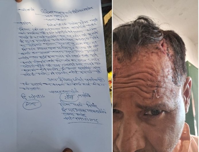 Hardoi: पुरानी रंजिश में दो भाइयों के परिवारों में खूनी संघर्ष, पति-पत्नी घायल। 