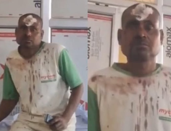Hardoi: 56 दिन बाद दर्ज हुई मारपीट की रिपोर्ट: क्षेत्राधिकारी के आदेश पर दो आरोपियों के खिलाफ मुकदमा