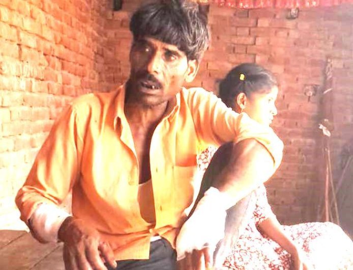 Sitapur : खेत में चारा काटने गए ग्रामीण पर जंगली सियार का जानलेवा हमला, चीख-पुकार सुनकर दौड़े ग्रामीणों ने बचाई जान