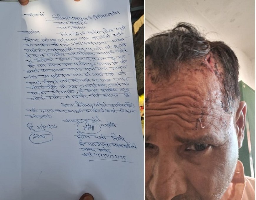 Hardoi: पुरानी रंजिश में दो भाइयों के परिवारों में खूनी संघर्ष, पति-पत्नी घायल। 