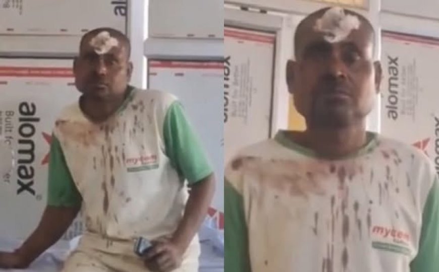 Hardoi: 56 दिन बाद दर्ज हुई मारपीट की रिपोर्ट: क्षेत्राधिकारी के आदेश पर दो आरोपियों के खिलाफ मुकदमा