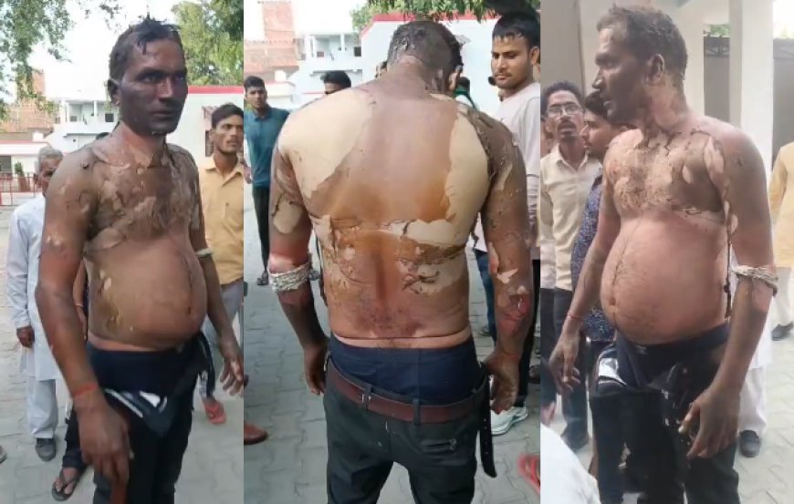 Sambhal : मुकदमे के डर से ग्रामीण ने खुद को लगाई आग, छेड़छाड़ के आरोप पर SP का बड़ा बयान
