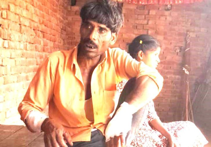 Sitapur : खेत में चारा काटने गए ग्रामीण पर जंगली सियार का जानलेवा हमला, चीख-पुकार सुनकर दौड़े ग्रामीणों ने बचाई जान