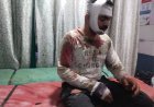 Deoband Accident: देवबंद में नीलगाय से टकराई बाइक, हादसे में एक युवक की मौत, बास्केटबॉल खिलाड़ी गंभीर