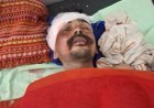 Hardoi Road Accident: हरपालपुर में अज्ञात वाहन ने बाइक को मारी जोरदार टक्कर, हादसे में युवक गंभीर रूप से घायल