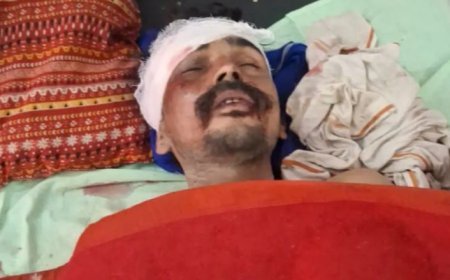 Hardoi Road Accident: हरपालपुर में अज्ञात वाहन ने बाइक को मारी जोरदार टक्कर, हादसे में युवक गंभीर रूप से घायल