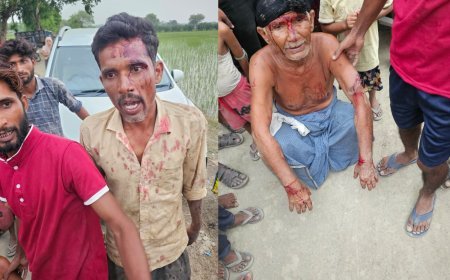 हरदोई में सिंचाई पाइप फटने को लेकर दो पक्षों में खूनी संघर्ष, लाठी-डंडे चलने से कई लोग गंभीर रूप से घायल