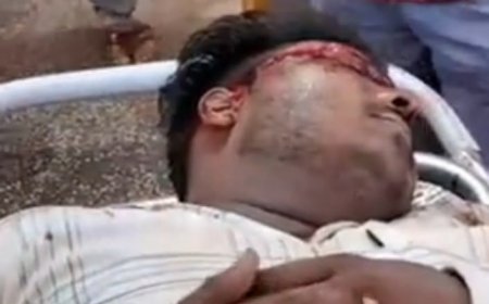 Hardoi Accident News: गंगा एक्सप्रेसवे की सर्विस लेन पर भीषण हादसा, अज्ञात वाहन की टक्कर से बाइक सवार गंभीर, मेडिकल कॉलेज रेफर