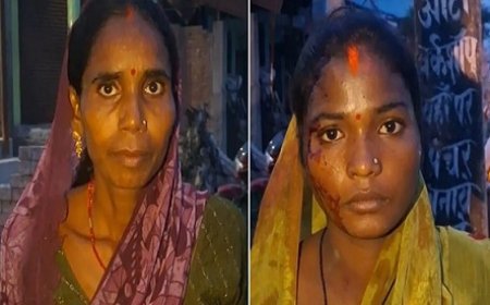 Hardoi: गाली-गलौज का विरोध करना पड़ा भारी, देवरानी-जेठानी को लाठी-डंडों से पीटा