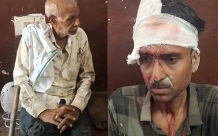 Hardoi News: हरपालपुर कोतवाली के सामने टेंपो ने बाइक में मारी टक्कर, पिता-पुत्र गंभीर घायल
