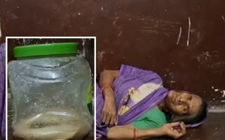 Hardoi: वृद्ध महिला को जहरीले सांप ने डसा, हालत गंभीर, परिजन डिब्बे में बंद कर जिंदा सांप भी अस्पताल ले पहुंचे