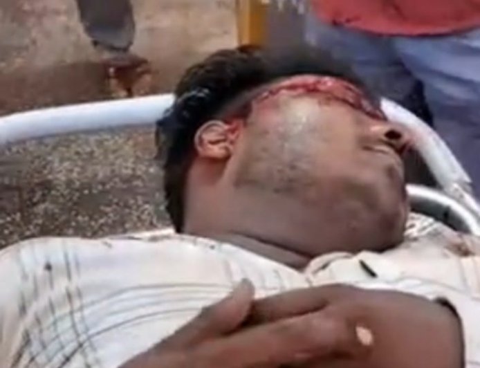 Hardoi Accident News: गंगा एक्सप्रेसवे की सर्विस लेन पर भीषण हादसा, अज्ञात वाहन की टक्कर से बाइक सवार गंभीर, मेडिकल कॉलेज रेफर