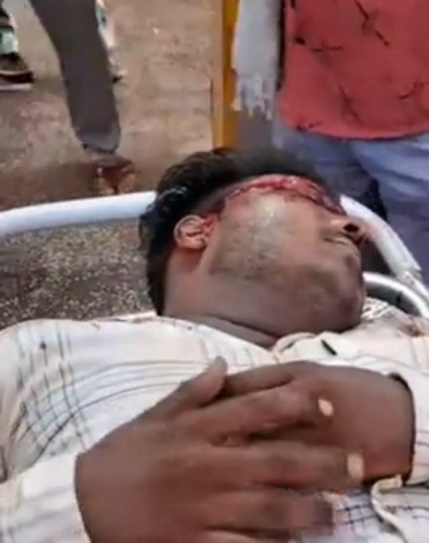Hardoi Accident News: गंगा एक्सप्रेसवे की सर्विस लेन पर भीषण हादसा, अज्ञात वाहन की टक्कर से बाइक सवार गंभीर, मेडिकल कॉलेज रेफर