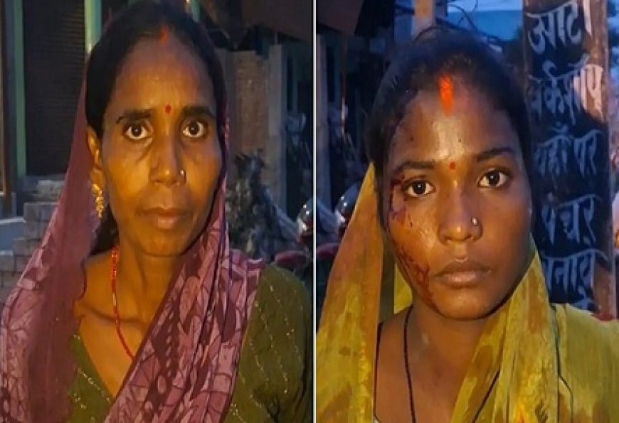 Hardoi: गाली-गलौज का विरोध करना पड़ा भारी, देवरानी-जेठानी को लाठी-डंडों से पीटा