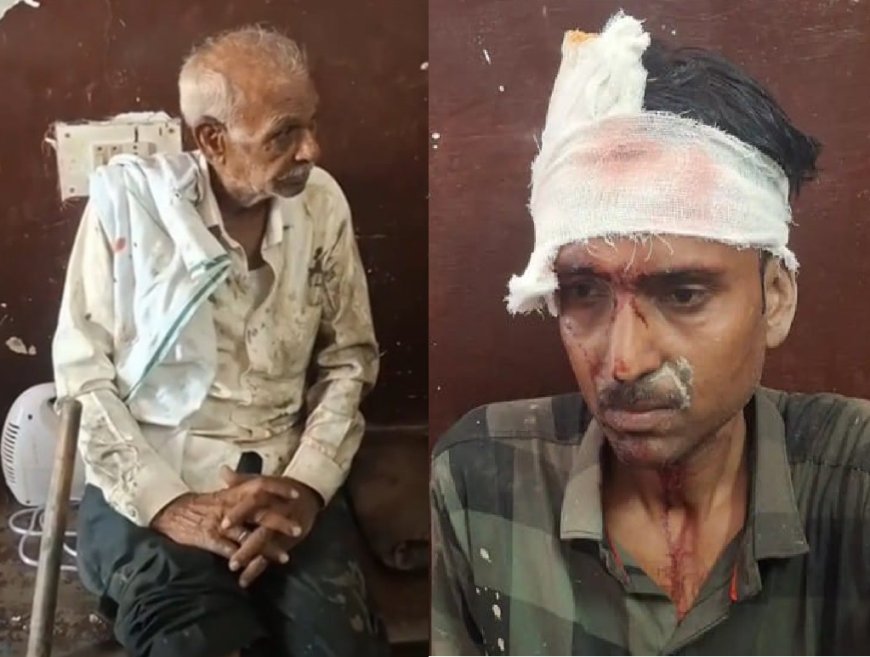 Hardoi News: हरपालपुर कोतवाली के सामने टेंपो ने बाइक में मारी टक्कर, पिता-पुत्र गंभीर घायल