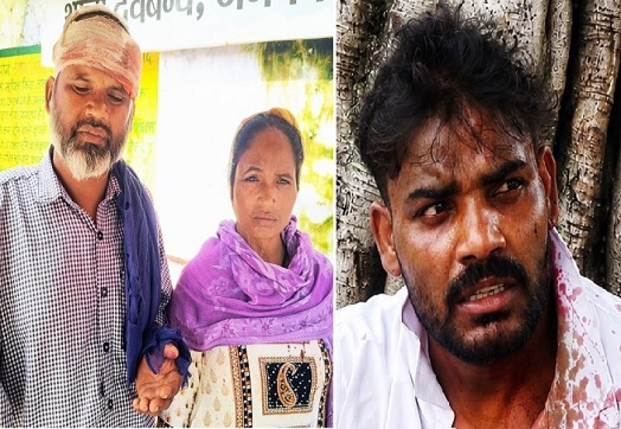 Deoband News Today: मारपीट की अलग-अलग घटनाओं में दंपती समेत चाची-भतीजा घायल, पुलिस जांच में जुटी