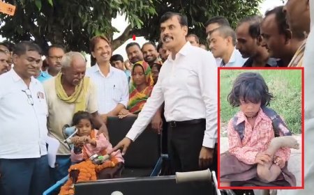 Ballia News Today: एक पैर से स्कूल जाती थी रागिनी, दर्दभरी अपील सुन पिघला DM का दिल; घर पहुंचकर दी ट्राईसाइकिल और खेलकूद की किट