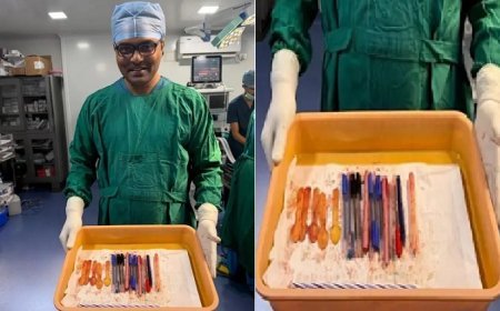 Stomach Surgery Case: पेट में मिले 13 पेन और लकड़ी के चम्मच, मेडिकल टीम ने बताया कैसे बची महिला की जान