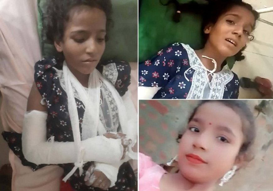 Hardoi Student Death: स्कूल में मारपीट के बाद 13 वर्षीय छात्रा की मौत, शिक्षक और सहपाठी छात्रा पर गैर इरादतन हत्या का मुकदमा