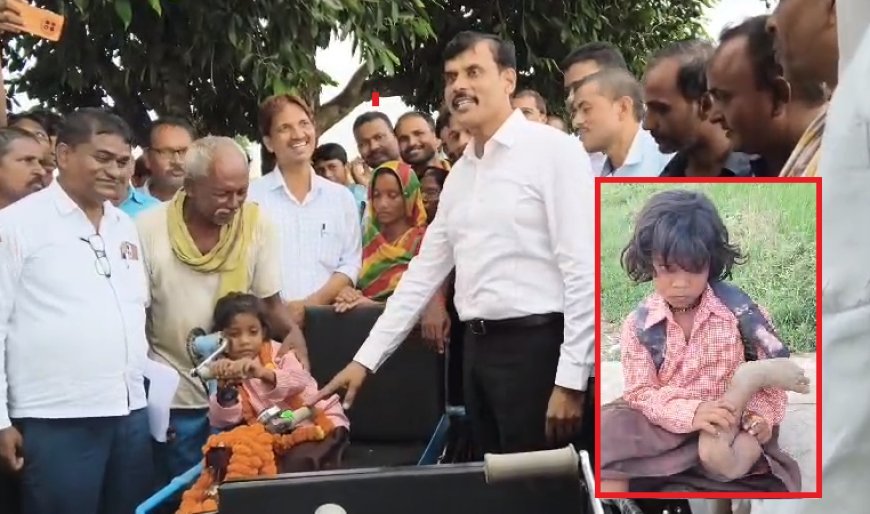 Ballia News Today: एक पैर से स्कूल जाती थी रागिनी, दर्दभरी अपील सुन पिघला DM का दिल; घर पहुंचकर दी ट्राईसाइकिल और खेलकूद की किट
