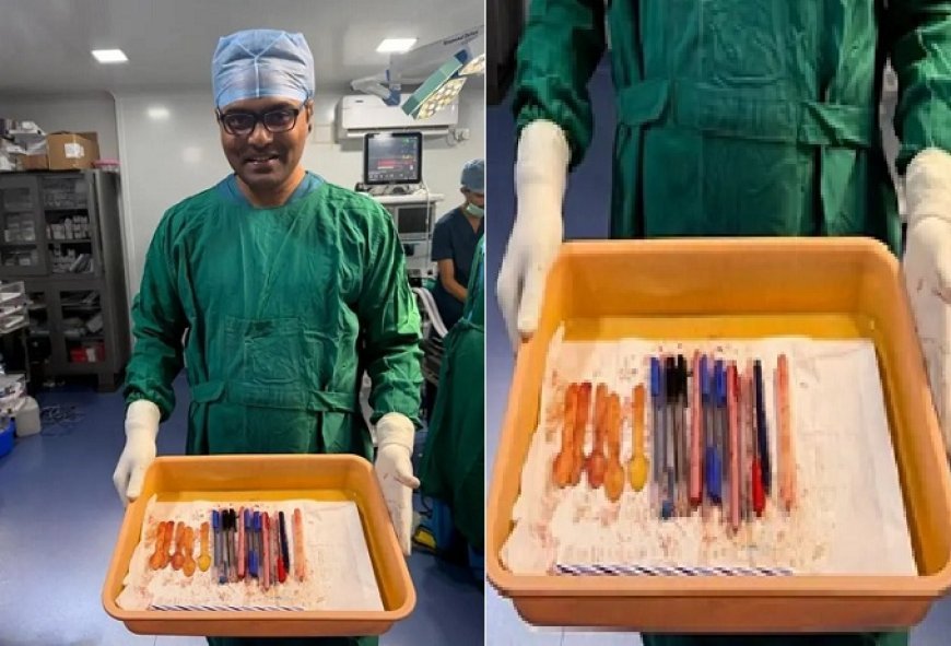 Stomach Surgery Case: पेट में मिले 13 पेन और लकड़ी के चम्मच, मेडिकल टीम ने बताया कैसे बची महिला की जान