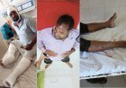 हरदोई में खबर से बौखलाए दबंगों ने शिक्षक पर बोला जानलेवा हमला, कनपटी पर तमंचा तानकर लूटे 25 हजार