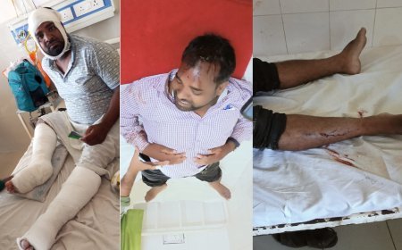 हरदोई में खबर से बौखलाए दबंगों ने शिक्षक पर बोला जानलेवा हमला, कनपटी पर तमंचा तानकर लूटे 25 हजार