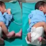 treatment-of-a-child-born-in-muzaffarnagar-with-four-arms-and-four-legs-in-meerut-medical-college